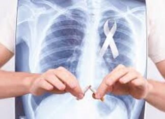 Instan a dejar el cigarrillo para disminuir el riesgo