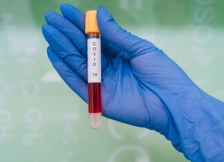 Otros 19 uruguayenses se infectaron con el covid-19