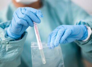 Detectaron otros 33 casos en Concepción del Uruguay