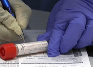 Otros 69 uruguayenses dieron positivo al covid-19