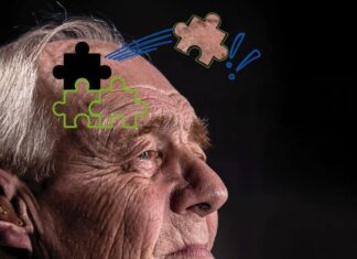 La Histórica se suma a concientizar sobre Alzheimer