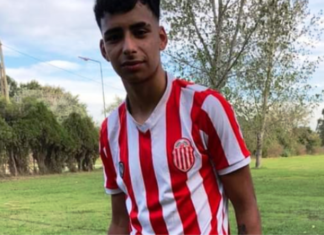 Lo quemaron con un cigarrillo