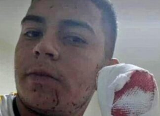 Perdió cuatro dedos tras feroz ataque