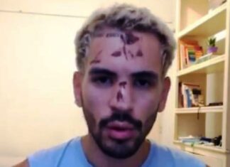 Joven denunció ataque homofóbico