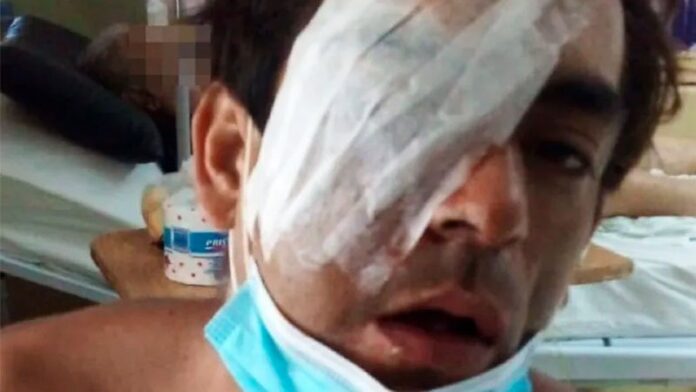 Pagina 7 2 de marzo 2022 Fue apuñalado en el rostro y perdió un ojo