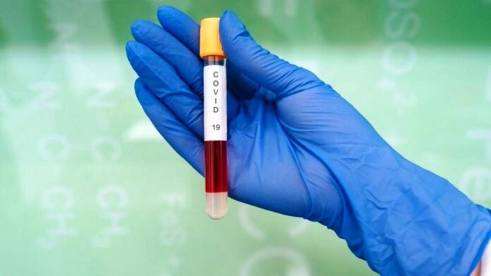p4 coronavirus1