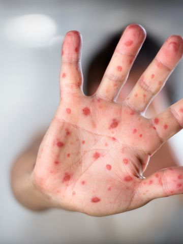 6286a52cb1646_360_480!