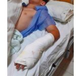 Pagina 7 (5) Alumno se lesionó la mano con una sierra