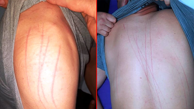 Policía atacado está bajo tratamiento y muy asustado | DIARIO LA CALLE