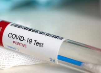 En Entre Ríos se registraron 79 nuevos casos de Covid: Son 213 mil las personas que tuvieron la enfermedad