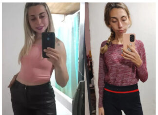 Una joven busca ayuda para costear su operación