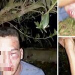 Pagina 6 Pactó cita con una niña de 12 años, lo descubrieron y terminó desfigurado