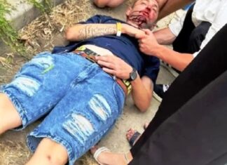 Detienen al autor de la brutal golpiza en Año Nuevo