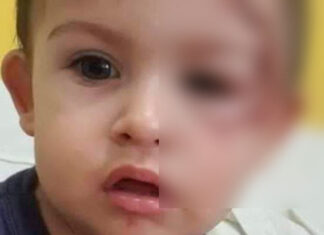 Padres arrojaron de moto a su hijo y se fugaron: El bebé tenía cocaína en sangre