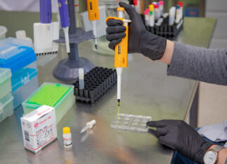 Sífilis: Las personas pueden tener la infección y no saberlo, por lo que es clave testearse