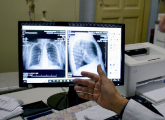 Humo en el ambiente: Afecciones respiratorias y cómo evitar complicaciones