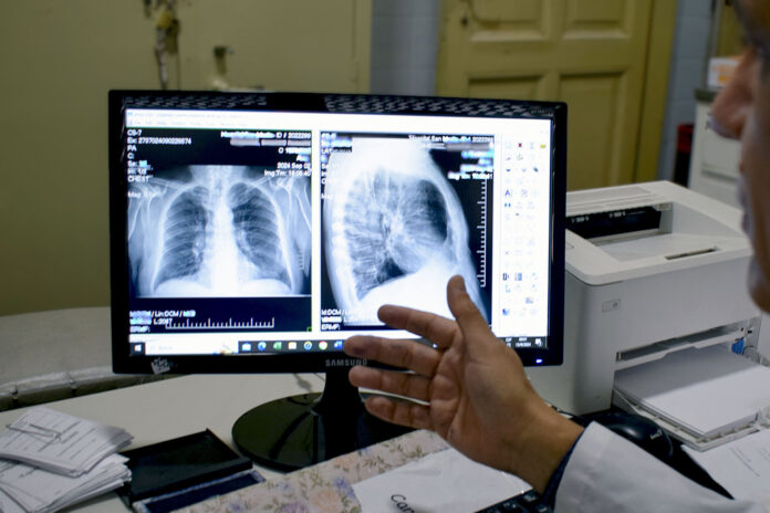 salud - recomendaciones por el humo en el ambiente1