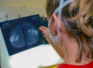 Cáncer: La mejor cura es la prevención