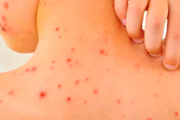 e_1741280751_62391_webp