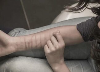 Salud mental. La relevancia de detectar y abordar a tiempo los cortes superficiales autoinfligidos