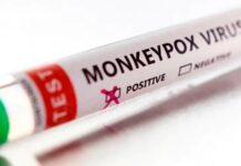 Confirman el primer caso autóctono de viruela símica en Argentina: se trata de la variante más contagiosa y peligrosa