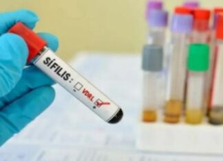 Los casos de sífilis en Entre Ríos aumentaron un 65 por ciento en el último año