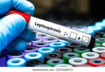 Entre Ríos acumula 15 casos de leptospirosis en lo que va del año