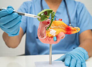 Prometedores resultados de un nuevo fármaco contra el cáncer de páncreas