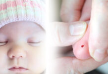 Fenilcetonuria: una enfermedad prevenible