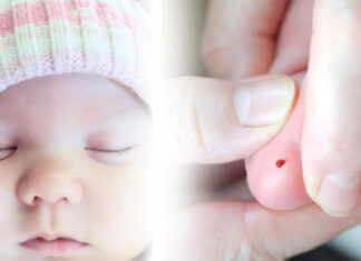 Fenilcetonuria: una enfermedad prevenible