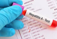 Aguas residuales revelan alta presencia de hepatitis E en el AMBA