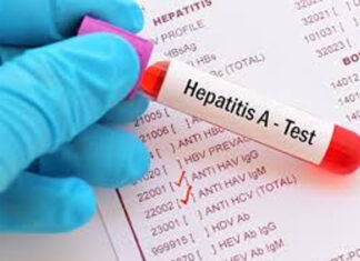 Aguas residuales revelan alta presencia de hepatitis E en el AMBA