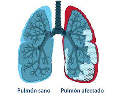 Sin-título-1